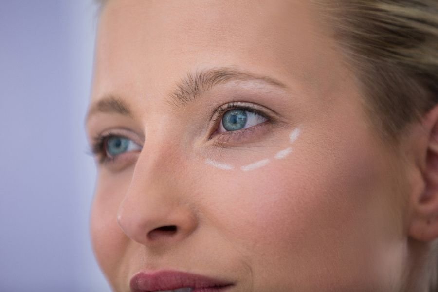 cómo eliminar las ojeras de forma eficaz