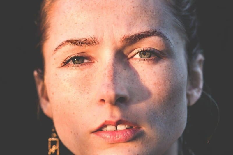¿Cuándo debemos acudir a un dermatólogo? 2 dermatologo trata lunares