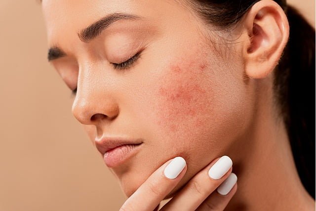 cuando acudir al dermatologo