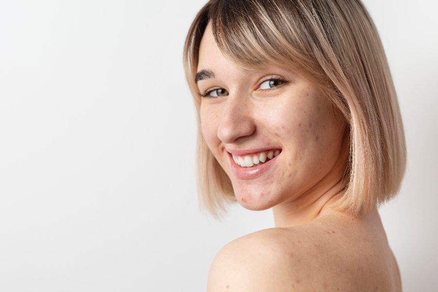 maquillaje piel con acné