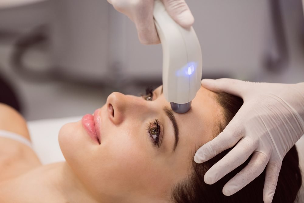 láser facial en Barcelona